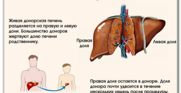Кто может быть донором печени при жизни